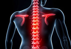 Upptäck effektiva övningar för att lindra smärta vid diskbråck l5/s1