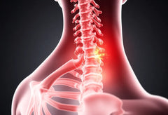 Upptäck orsakerna bakom smärta i höften och ländryggen: är det ischias?