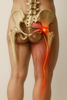 Upptäck hemligheterna bakom att lindra piriformis syndrom hemma