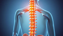 Upptäck osteopatins kraft mot diskbråck: en naturlig väg till smärtfrihet