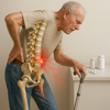 Smärtstillande vid spinal stenos: så lindrar du smärtan effektivt och hållbart