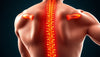Övningsläsare: hitta rätt ischias nerv övningar för snabb lindring